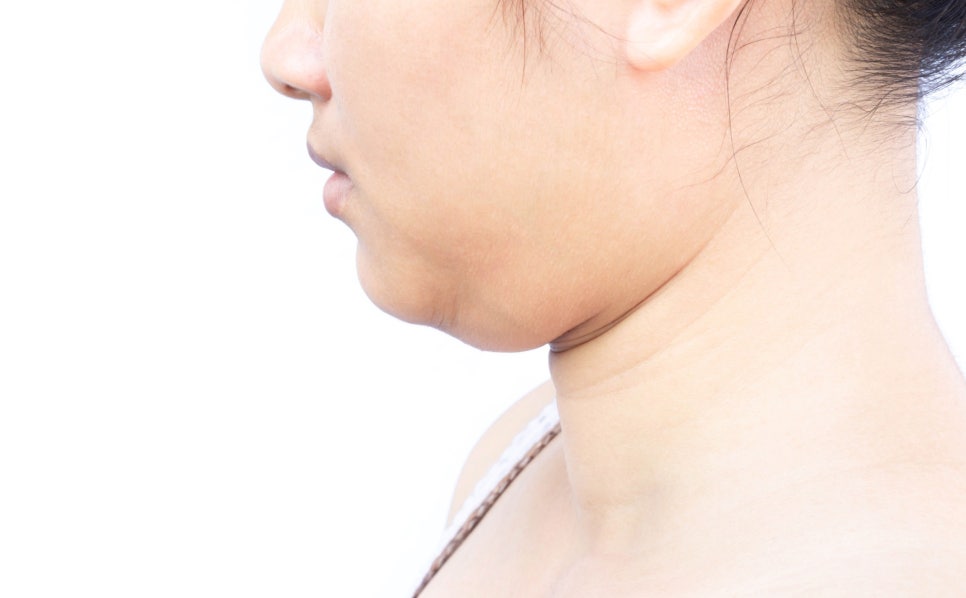 턱살보톡스, 성분부터 디자인까지 핵심만 알려드립니다 관련 이미지 1