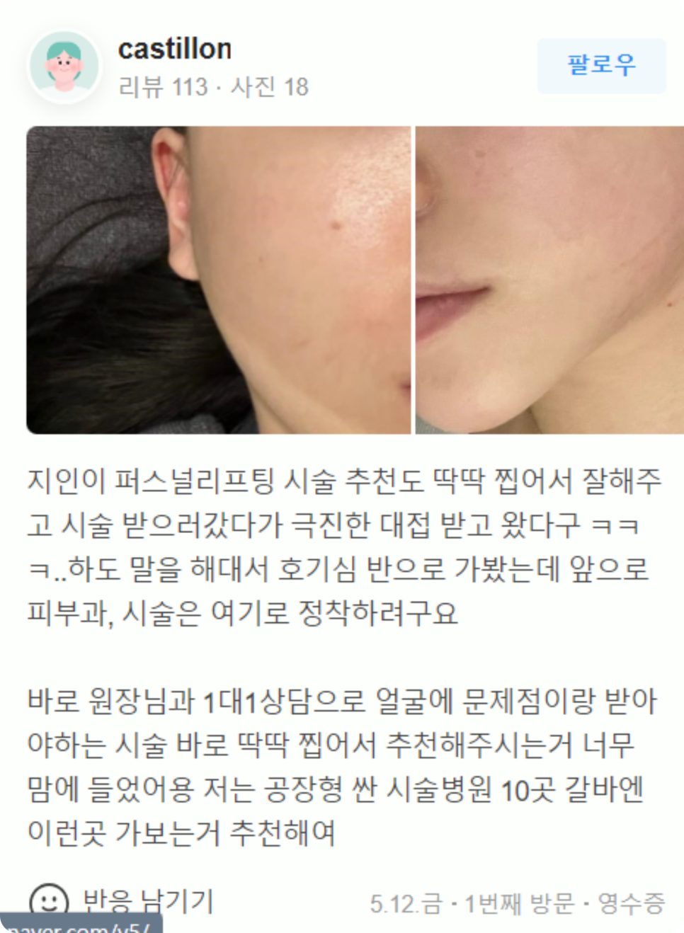 홍대피부관리 떨어지는 피부 탄력 확실하게 리프팅 하는 비결 (근처10분거리) 관련 이미지 18