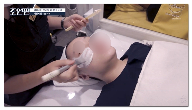 Scared of Ulthera Pain? How to Reduce the Pain (Not with Sedation) image 10
