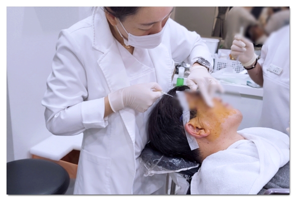 마리오네트 주름 시술, 타입별 효과 좋은 시술 선택 방법 관련 이미지 4