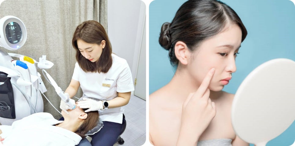 레이저토닝효과 제대로 보고 싶다면 ‘이것’ 중요합니다. 관련 이미지 7