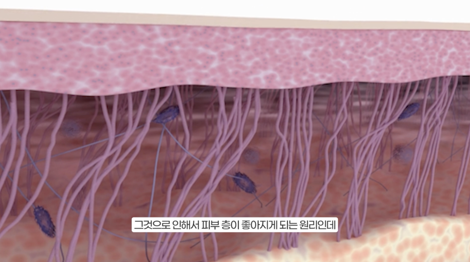 아무도 알려주지 않는 쥬베룩 볼륨 효과 관련 이미지 12