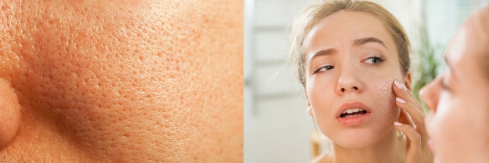 합정역피부관리, 병원을 선택할 때 관련 이미지 7