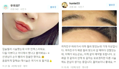 이마실리프팅으로 처진 눈 간단 해결! 관련 이미지 14