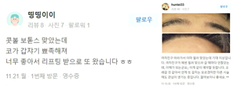 아이울쎄라 리프팅 필독! 관련 이미지 13