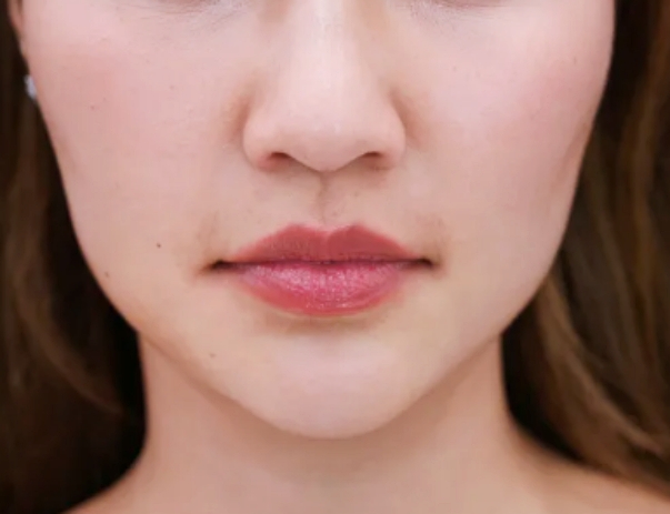 How to Get Peanut-Shaped Face Lifting Properly image 2