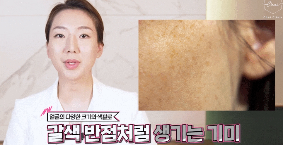 기미 피부관리 선택할 때 꼭 기억해야 할 것! 관련 이미지 4