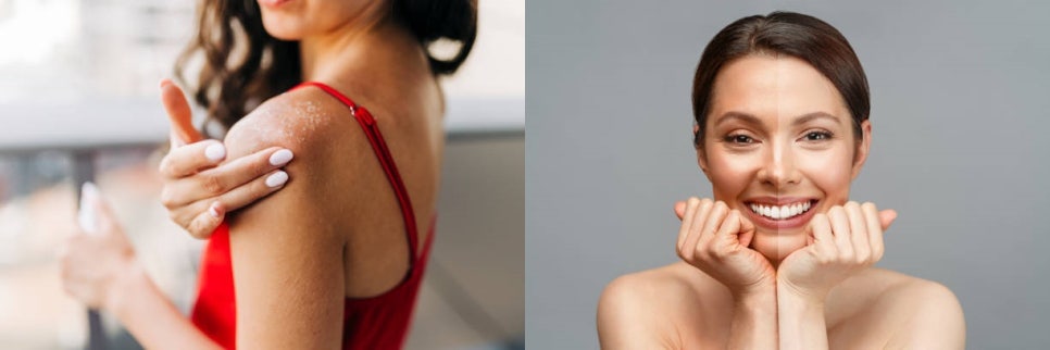 홍대여의사피부관리 늦기 전에 색소침착에서 벗어나는 법 관련 이미지 9