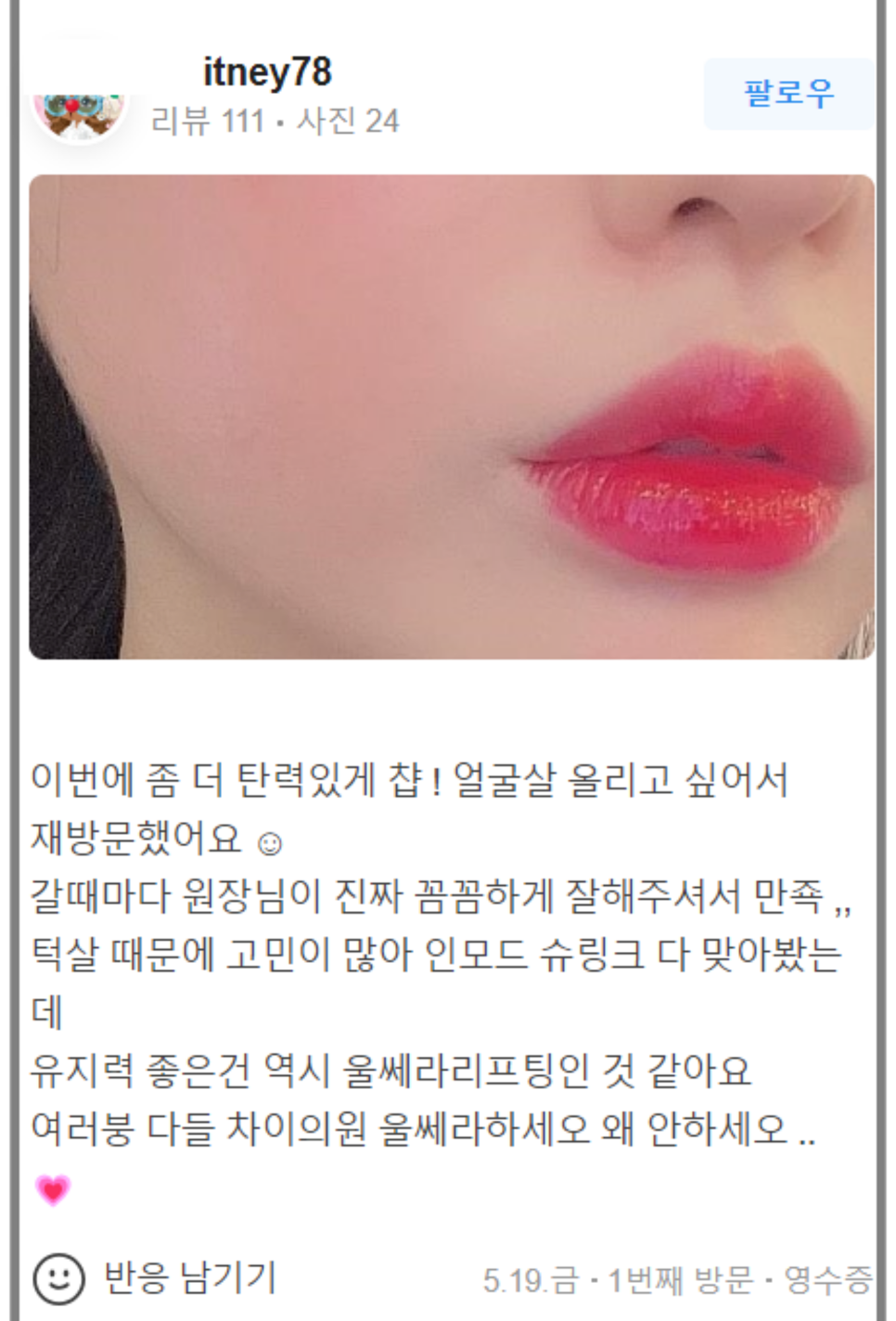 입꼬리보톡스 예쁜 미소 완성하는 차이의원 관련 이미지 11