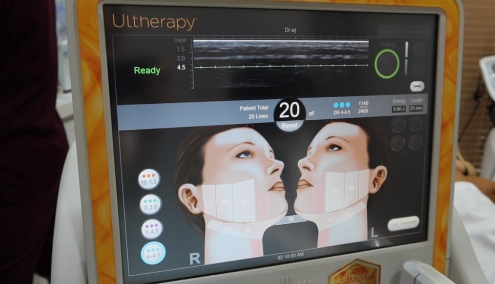 울쎄라 수면마취 없이 원장이 직접 시술받은 후기 관련 이미지 7