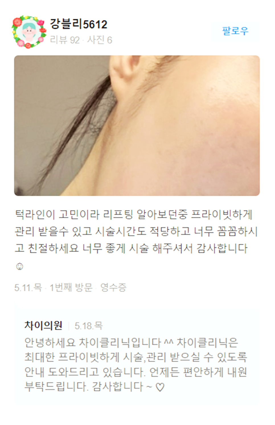 목주름레이저 타임머신효과, 탄력있는 목을 유지하세요! 관련 이미지 18