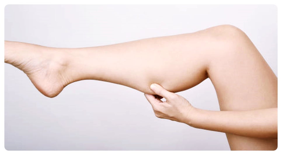 종아리보톡스 주기 언제가 적절할까요? 관련 이미지 4
