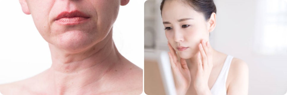 실루엣소프리프팅, 젊음의 생생함을 찾고 싶은 여러분에게 소개합니다. 관련 이미지 5