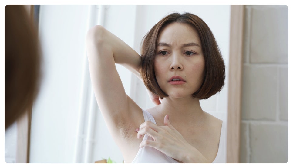 겨드랑이다한증보톡스 겨터파크 이제 그만 관련 이미지 3