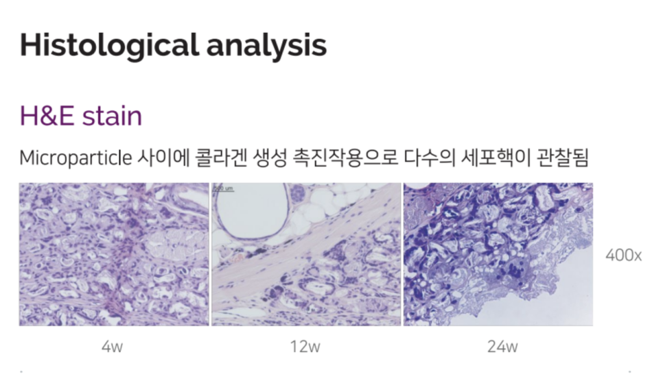 홍대 쥬베룩 볼륨의 개선 효과 관련 이미지 9
