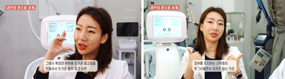 눈리프팅 효과를 120% 더 낼 수 있는 시술 대공개! 관련 이미지 8