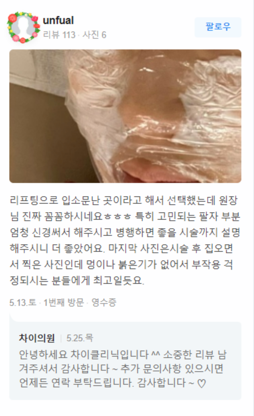 남자턱보톡스 OOO을 고려해야 관련 이미지 17