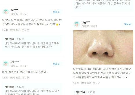 실리프팅 종류 유명한 시술이 효과 좋다? 거짓말입니다. 관련 이미지 11