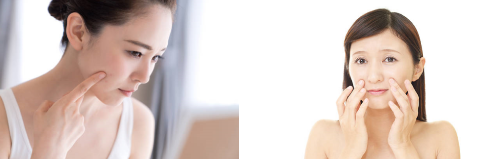 아현역피부관리 풀페이스더모톡신 주름개선 대박이네요! 관련 이미지 3
