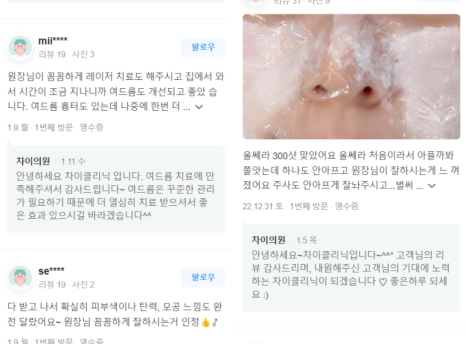 여드름흉터피부관리 관련 이미지 13