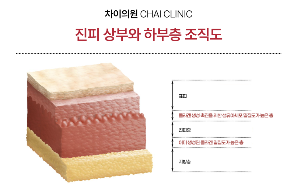 리쥬란 HB 효과와 부작용, 통증, 유지기간 총망라! 관련 이미지 3