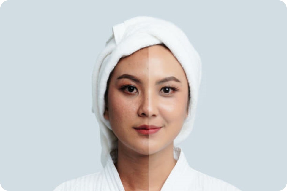 피코프락셀 주기, 더 큰 효과를 위해 확인하세요! 관련 이미지 5