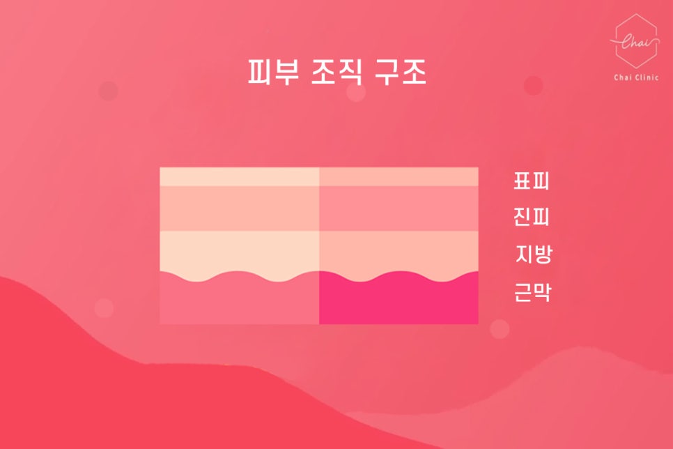 홍대리쥬란, 놓치면 안 되는 이것 관련 이미지 3