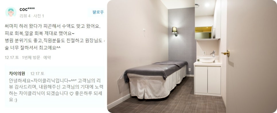 처진볼살리프팅 관련 이미지 14