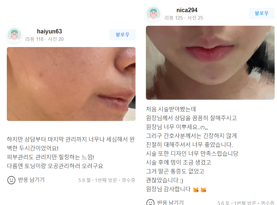 라비앙 비비레이저 환하고 깨끗한 피부 비결! 관련 이미지 5