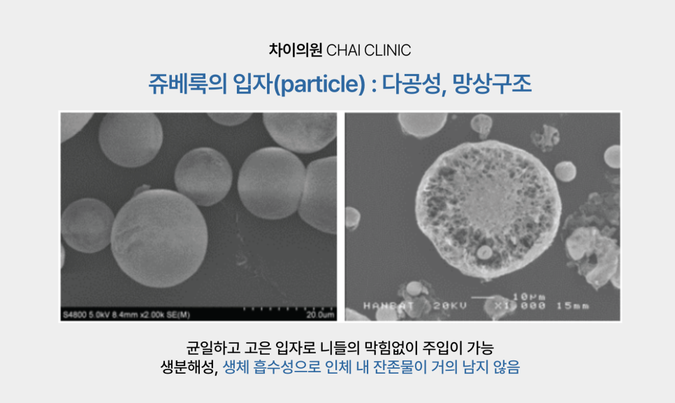리프팅 맛집! 차이의원에서 피부 리프팅 연말 결산 해요! 관련 이미지 6