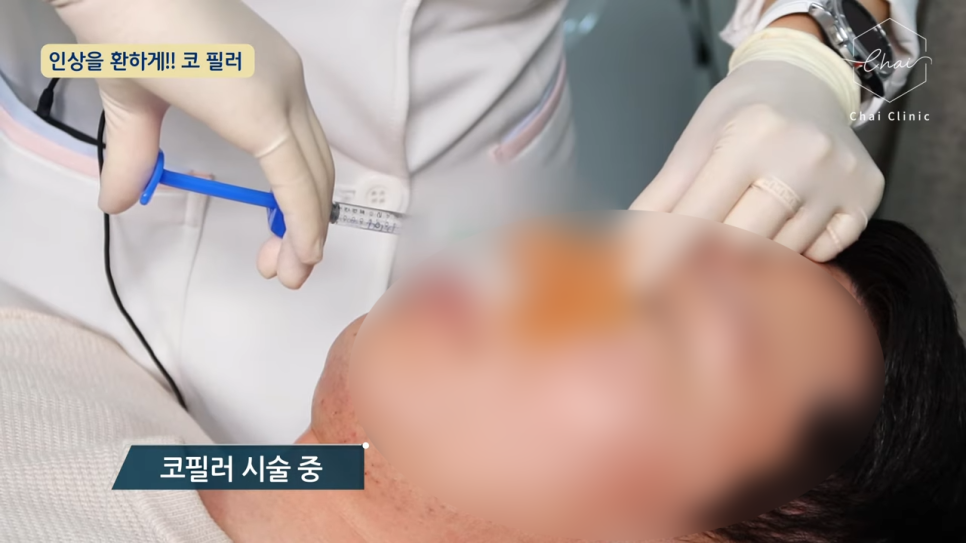 당산 필러 1:1 맞춤 시술을 통하여 안심하고 관련 이미지 3