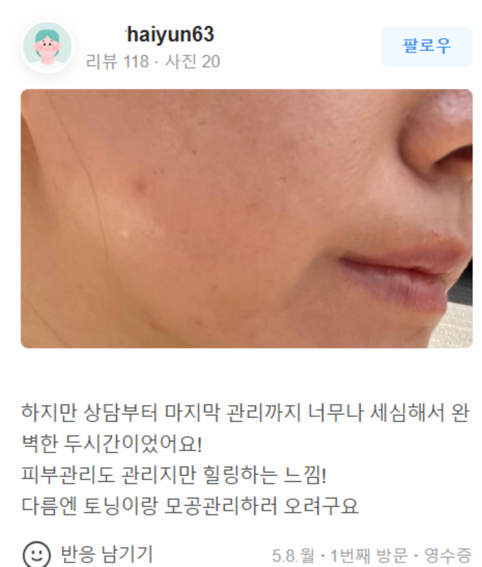 리쥬란HB플러스 고통 없이 예뻐지는 방법! 관련 이미지 10