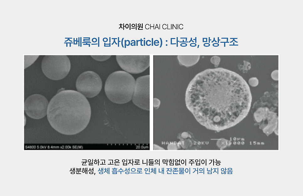 쥬베룩 효과 시기를 제대로 보기 위해선 관련 이미지 2