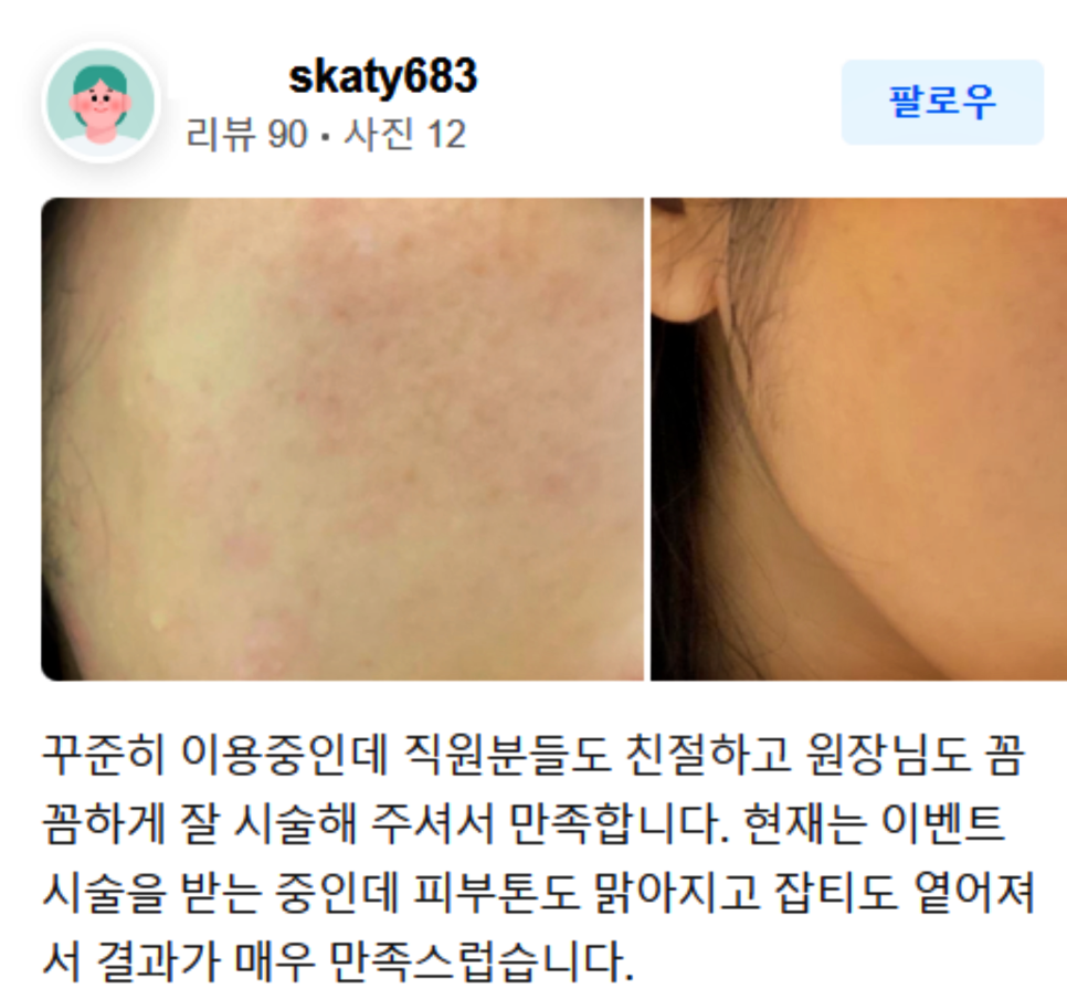 망원동피부관리, 여드름 흉터 지워드립니다 관련 이미지 13
