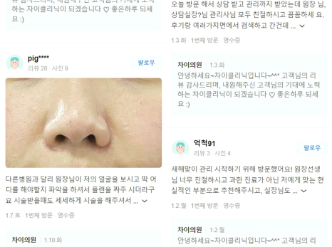 볼처짐리프팅, 이것 한 번으로 해결하세요! 관련 이미지 15