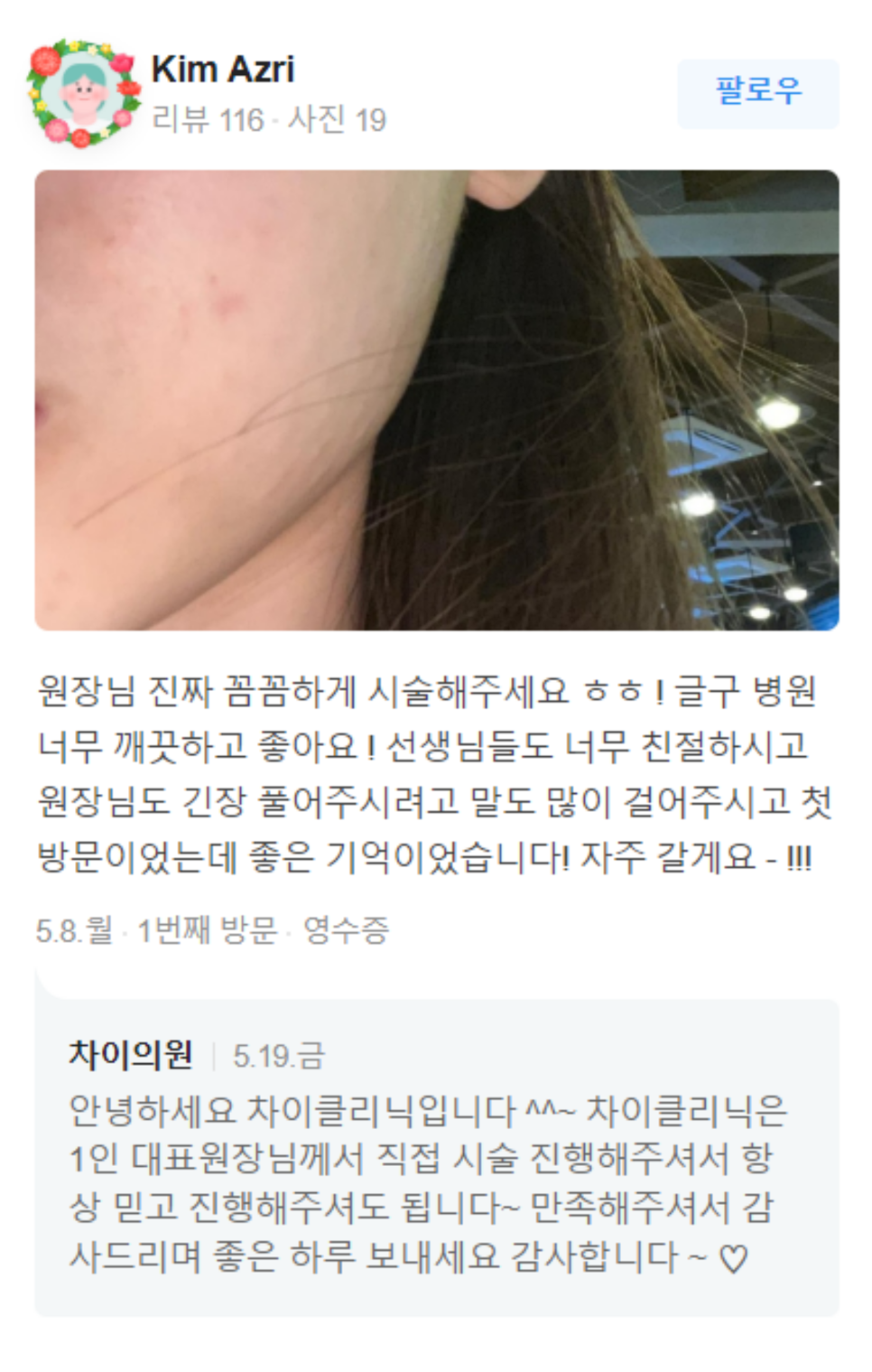 보톡스 종류 국산과 수입? 현명한 선택하려면 필독 관련 이미지 9