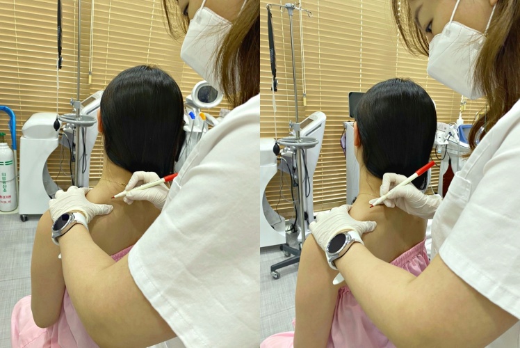 합정승모근보톡스 주의사항 &lsquo;이것&rsquo; 꼭 지켜주세요 관련 이미지 3