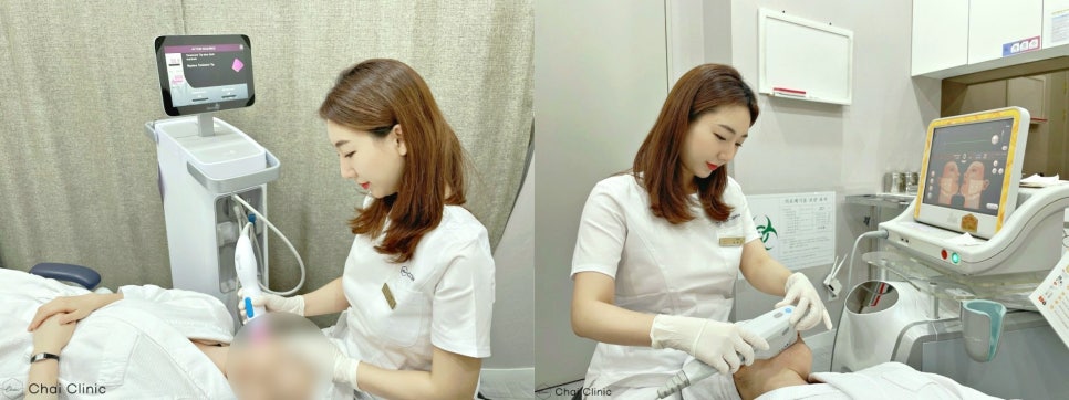 울써마지 붓기 걱정과 효과에 대해 알아보기 관련 이미지 6