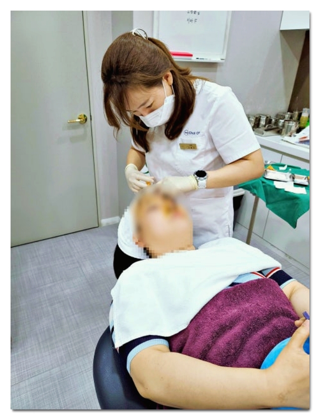 3 Things to Check to See the Effects of Hongdae Forehead Filler image 5