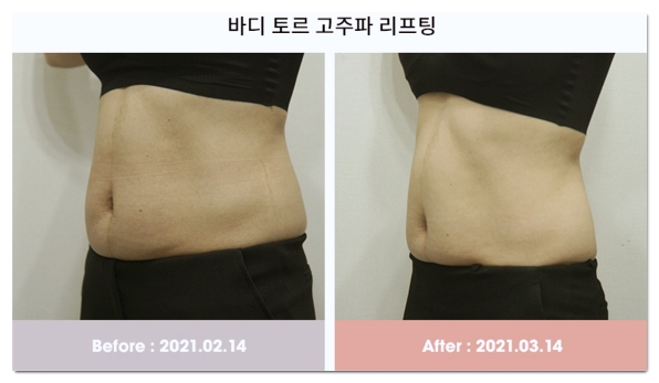 5 Things to Check Before Starting a Diet in Hapjeong image 2
