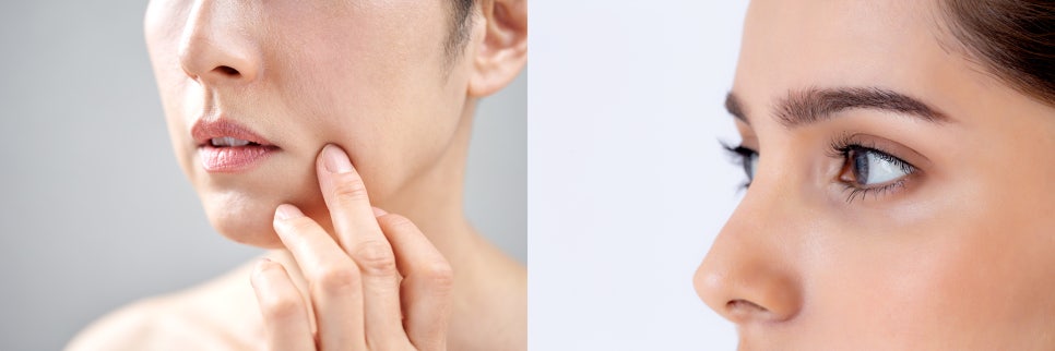 고주파레이저 생기넘치는 피부탄력의 비밀 관련 이미지 2