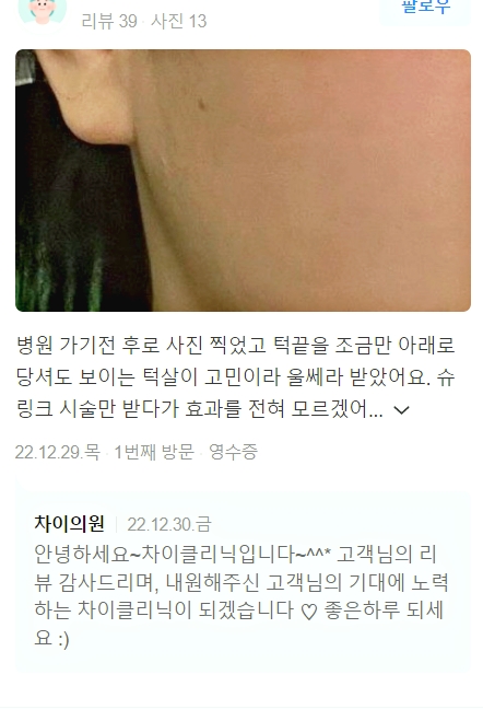 얼굴실리프팅가격 보다 관련 이미지 7