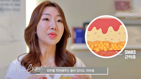 처진볼살리프팅 후기만 보고 결정하면 후회합니다! 관련 이미지 4