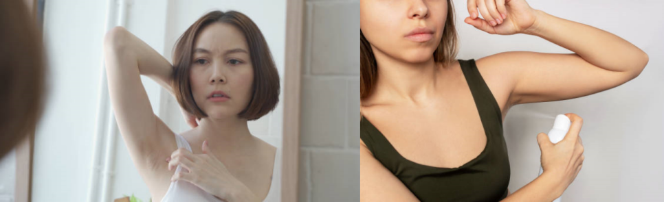 겨땀보톡스 올 여름 겨터파크 폐장하는 비결! 관련 이미지 8
