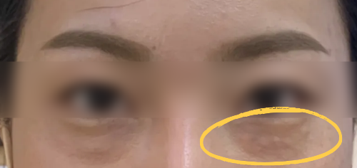 홍대 리투오 효과 높이는 조건 2가지 관련 이미지 5