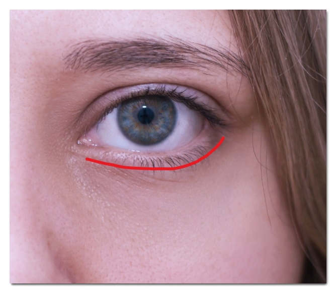 How to Find a Good Aegyo Filler Clinic in Hongdae: 3 Ways image 2