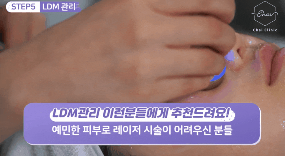 합정피부관리 물방울초음파 임산부도 가능합니다 관련 이미지 5