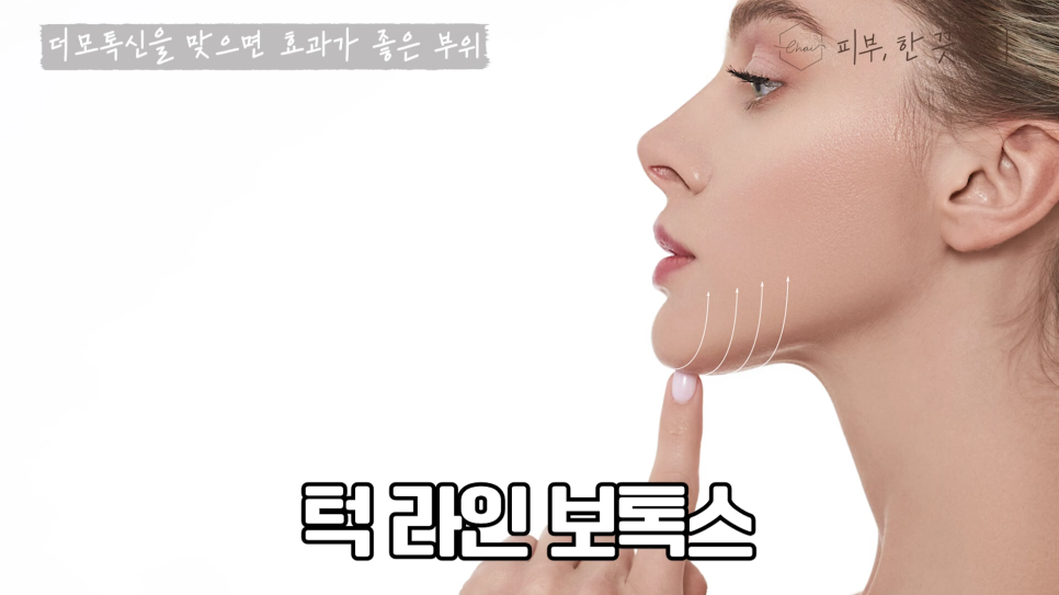 홍대 스킨보톡스 MZ 세대가 더모톡신에 주목하는 진짜 이유 관련 이미지 7