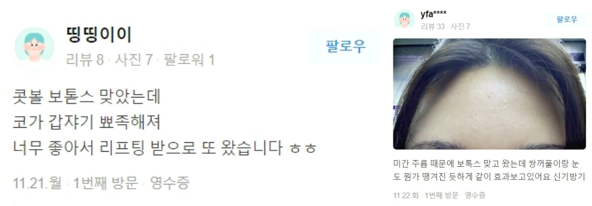 처진얼굴리프팅, 3살 어려지는 마법 같은 피부 만드세요. 관련 이미지 10