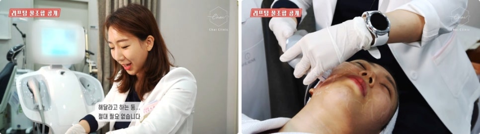 눈가 리프팅 탄력=기술력 어떻게 확인할까요?!😊 관련 이미지 7